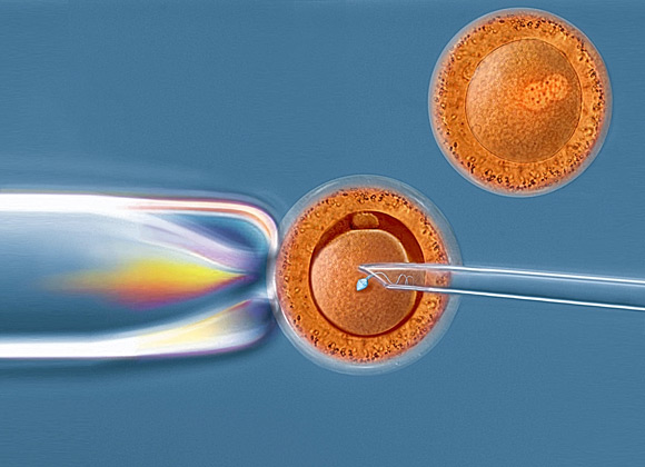 In Vitro Fertilisation process